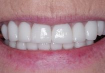 After - Springburndental