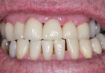 After - Springburndental