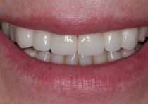 After - Springburndental