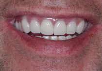 After - Springburndental