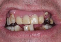 Before - Springburndental