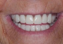 After - Springburndental