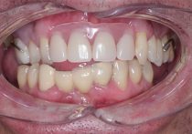 After - Springburndental